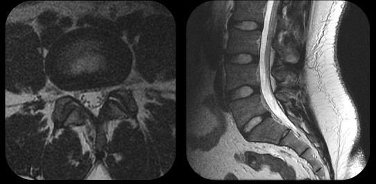 spineAI-fig-1