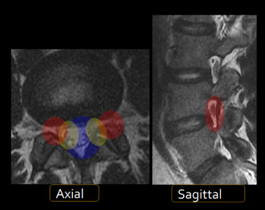 spineAI-fig-2